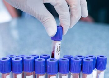 Бір тәулікте 114 адамнан коронавирус анықталды