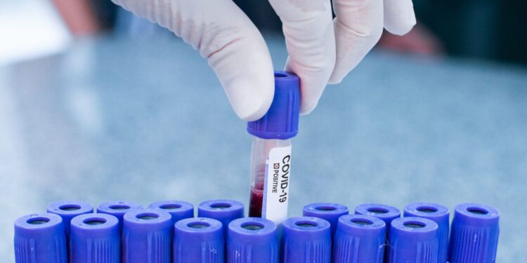 Бір тәулікте 114 адамнан коронавирус анықталды