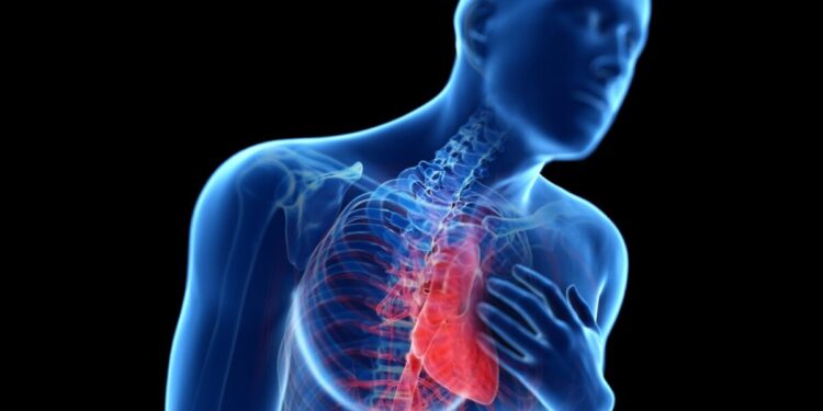 Демікпе қандай дерт