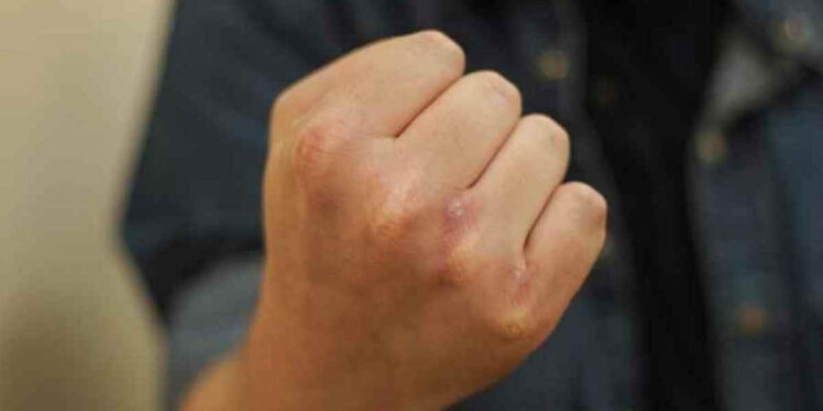 Алматыда 2007 жылғы жасөспірім хайп үшін қарияны соққыға жықты